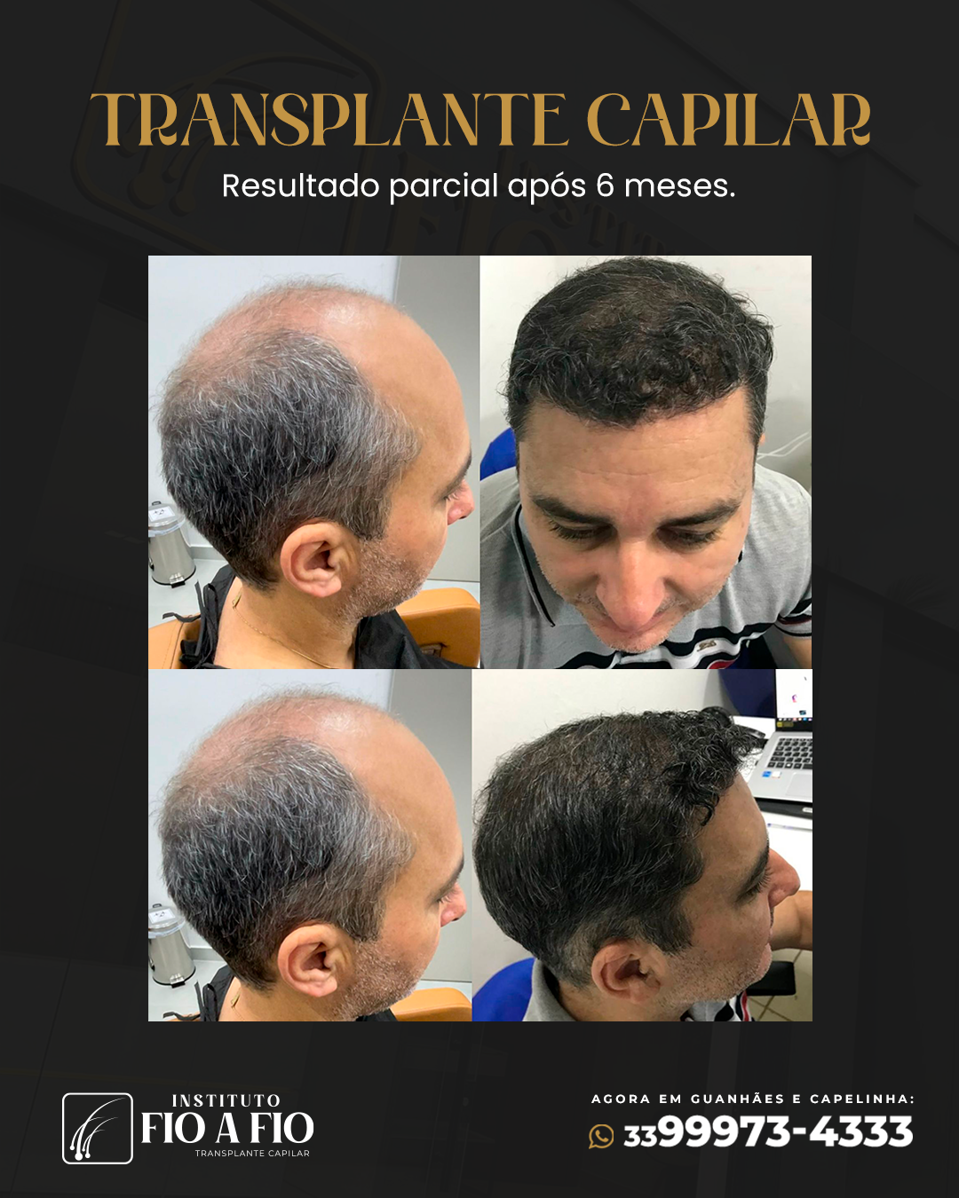 Antes-e-depois-2.png