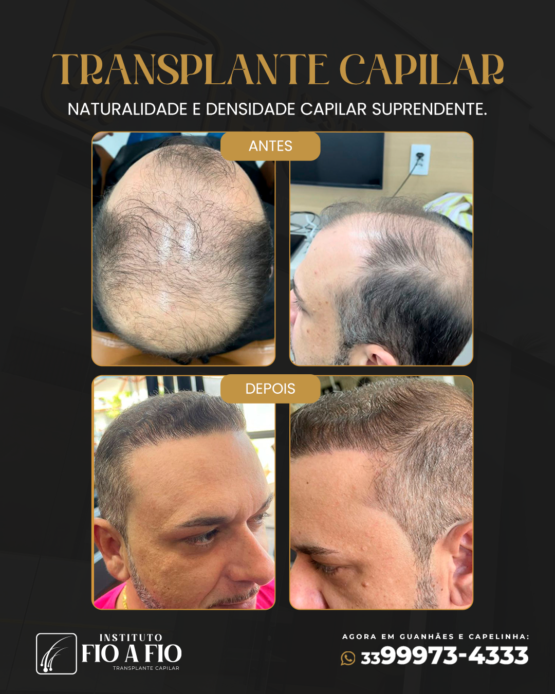 Antes-e-depois.png